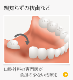 親知らずの抜歯と歯の移植